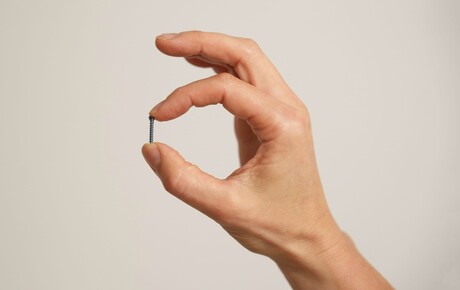 Minimalinvasive Fußoperation