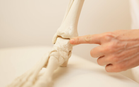 Sprunggelenk-Arthrodese