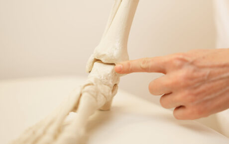 Sprunggelenk-Arthrodese