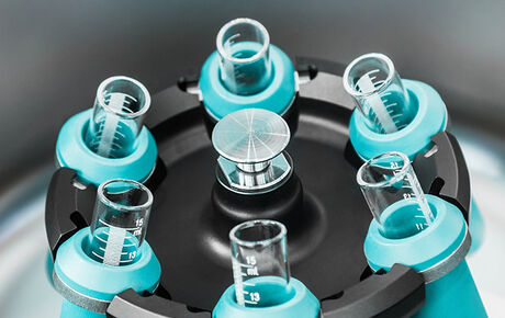 Eigenbluttherapie (ACP-Therapie)