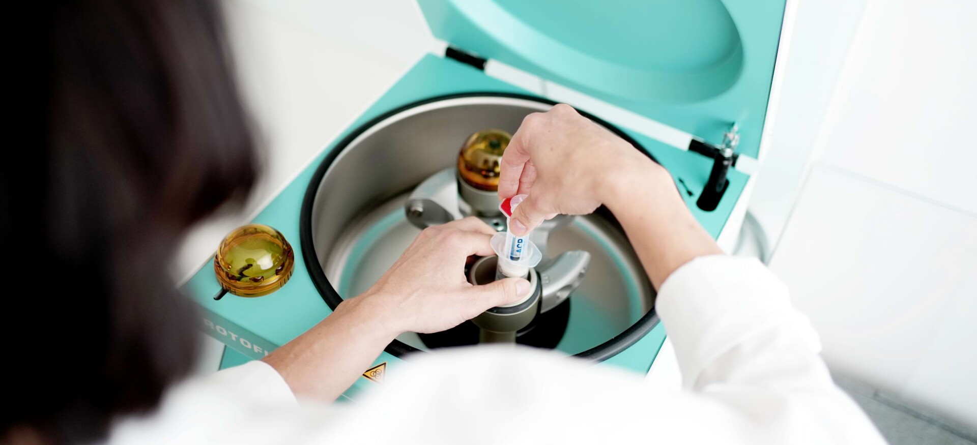 Eigenbluttherapie